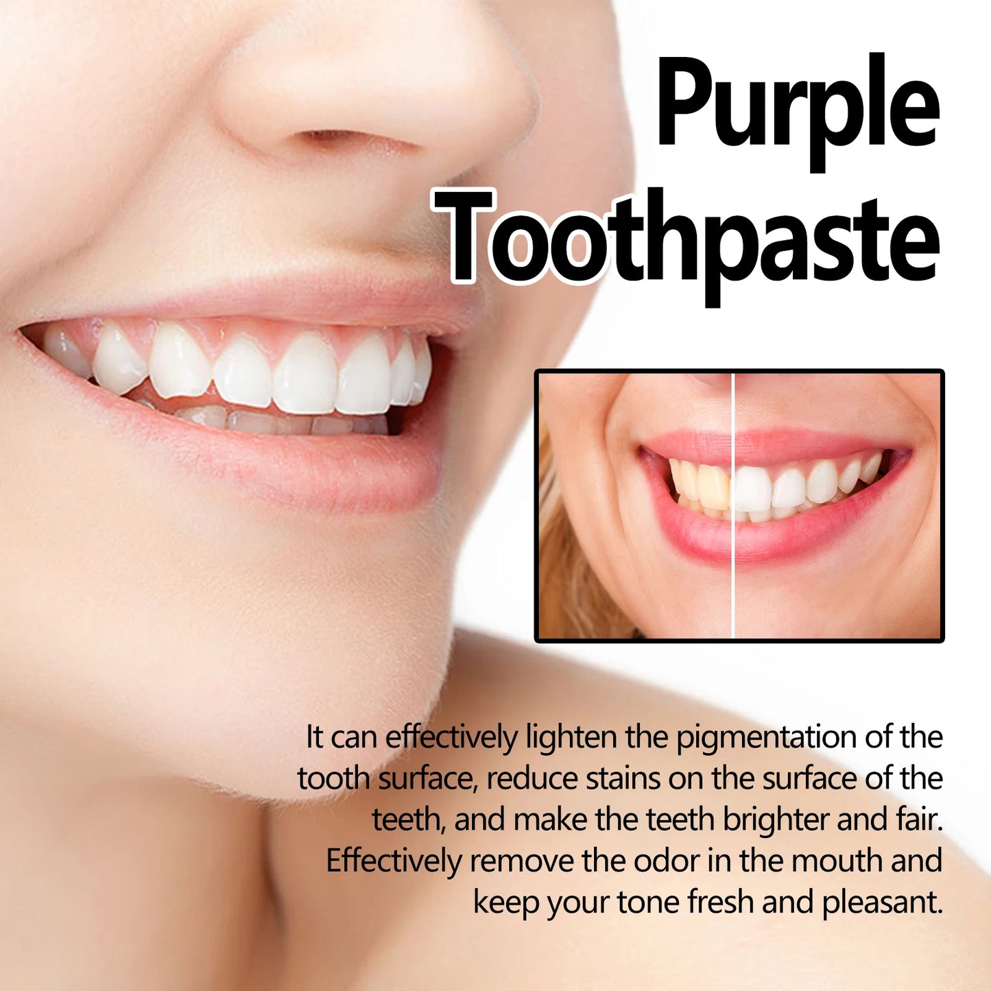 Oralhoe Purple Teeth Whitening